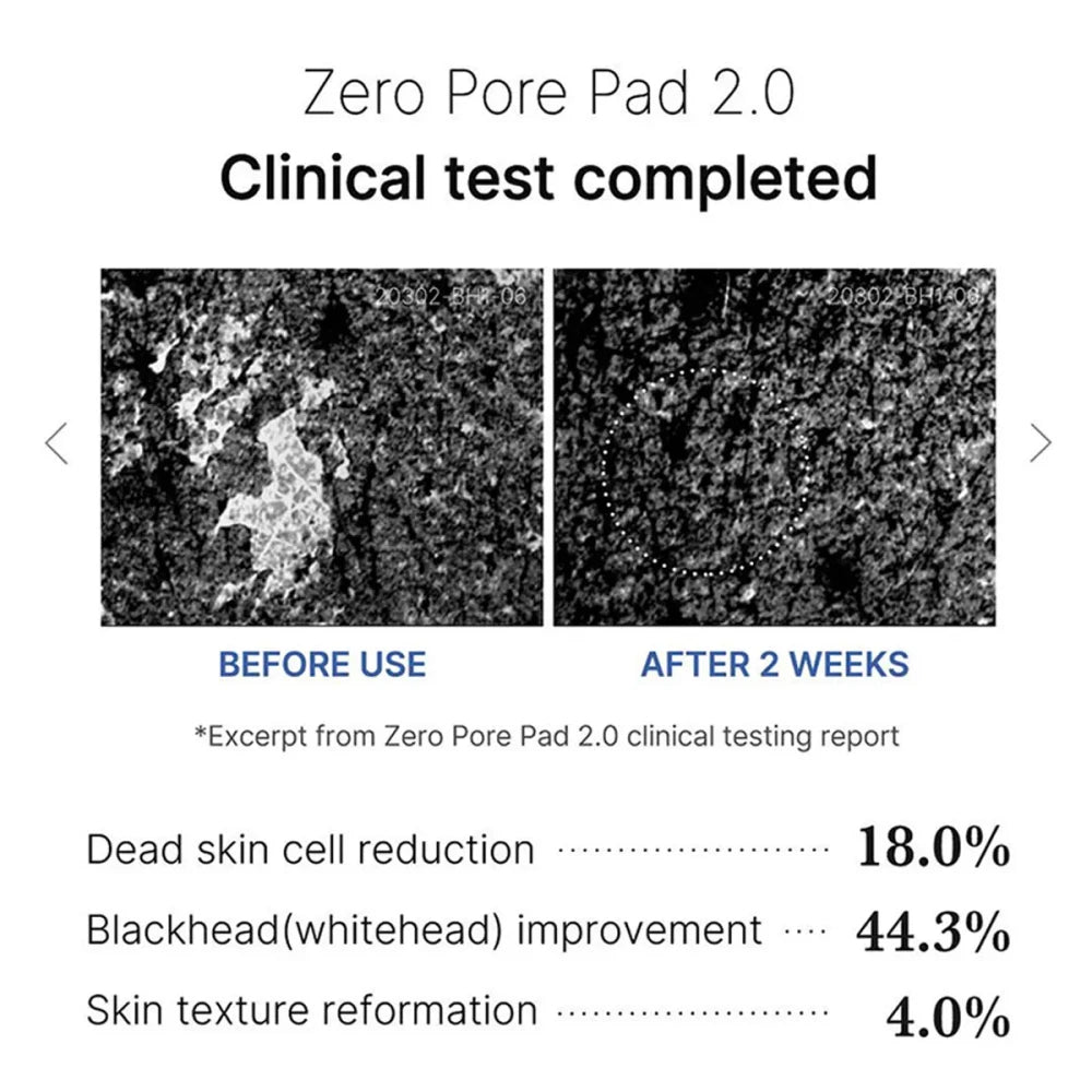 Medicube Zero Pore Pad 2.0